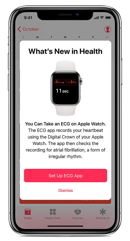 Set up ECG app on Apple Watch