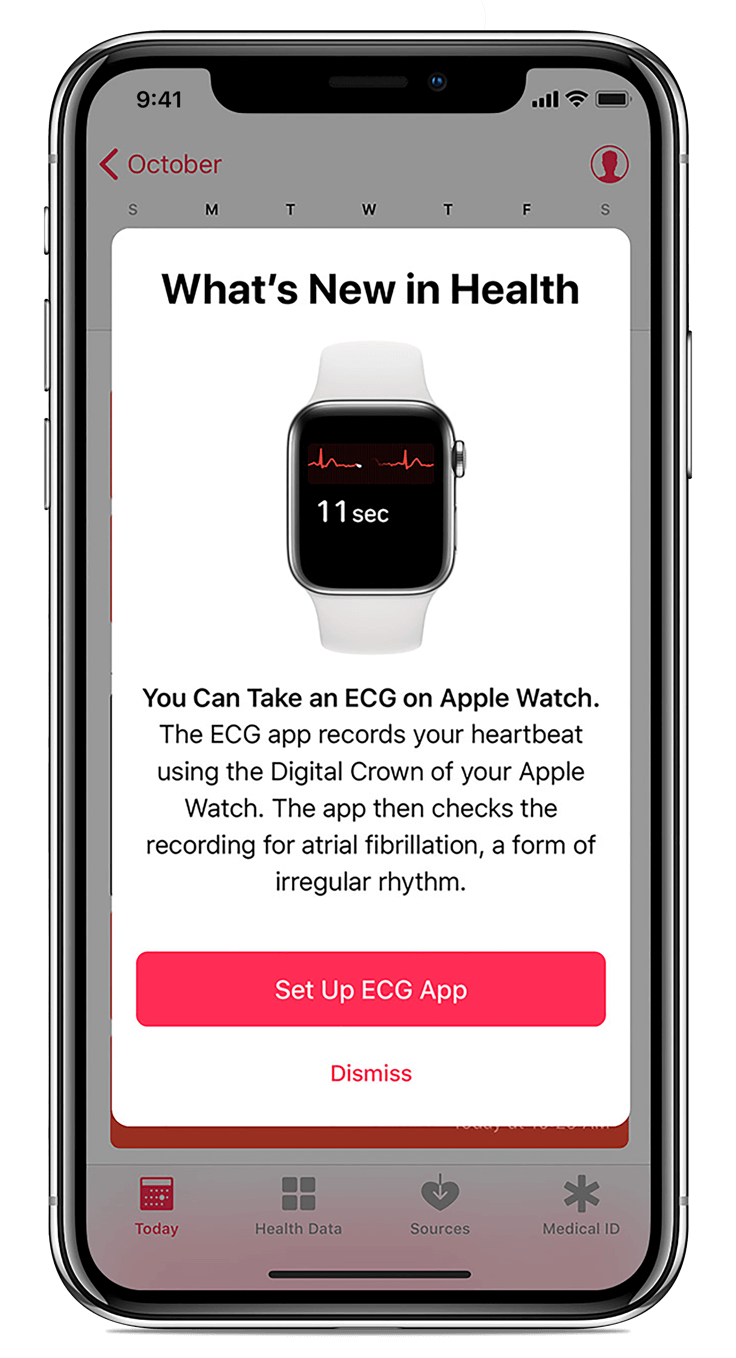 setting up ecg on apple watch