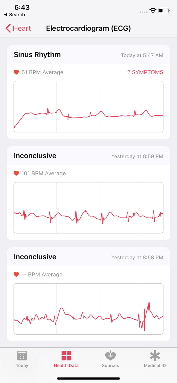 ecg update apple watch