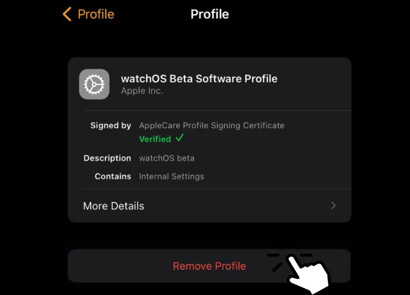 Click Remove Profile
